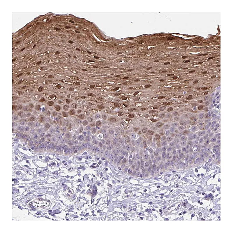 Atlas Antibodies Anti-TGM3 Antibody