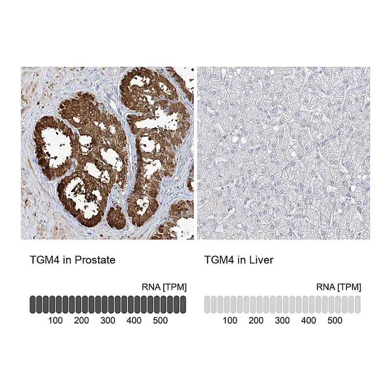Atlas Antibodies Anti-TGM4 Antibody