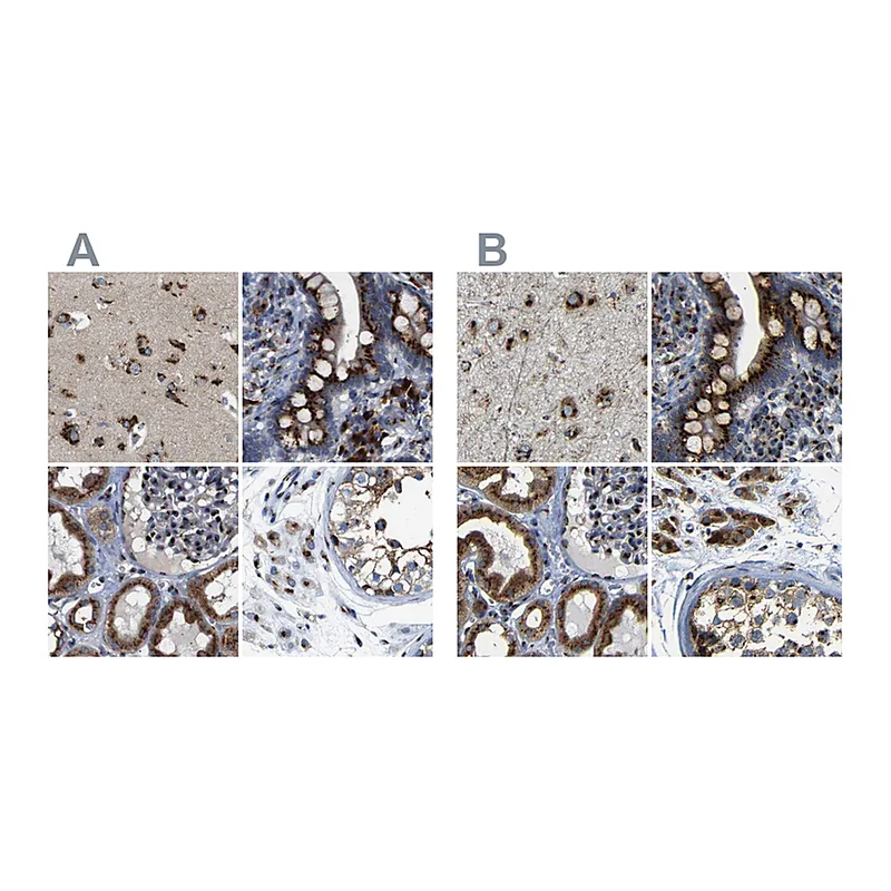 Atlas Antibodies Anti-TGOLN2 Antibody