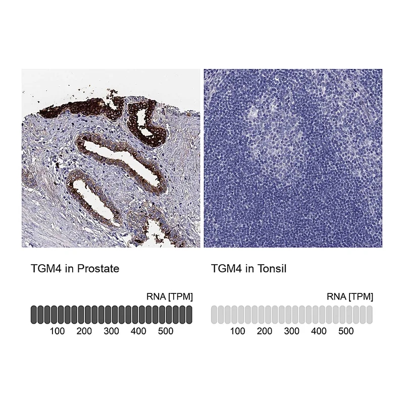 Atlas Antibodies Anti-TGM4 Antibody
