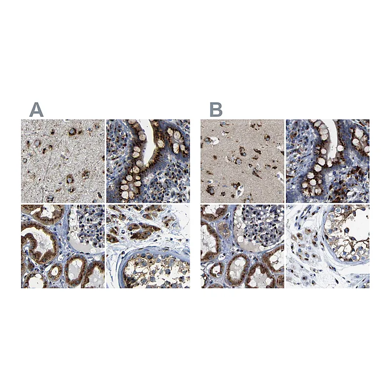 Atlas Antibodies Anti-TGOLN2 Antibody