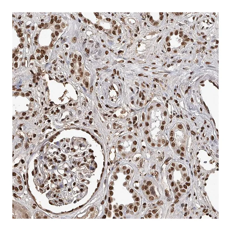 Atlas Antibodies Anti-TGS1 Antibody