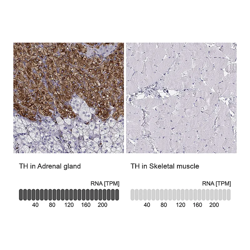 Atlas Antibodies Anti-TH Antibody