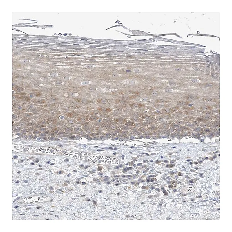 Atlas Antibodies Anti-THADA Antibody