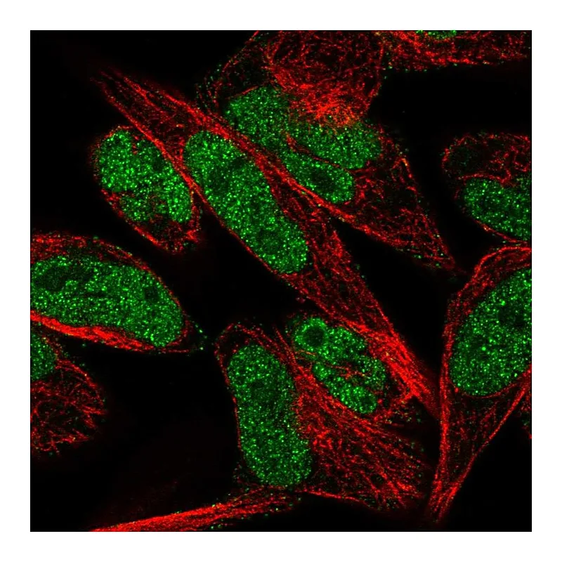 Atlas Antibodies Anti-THAP1 Antibody