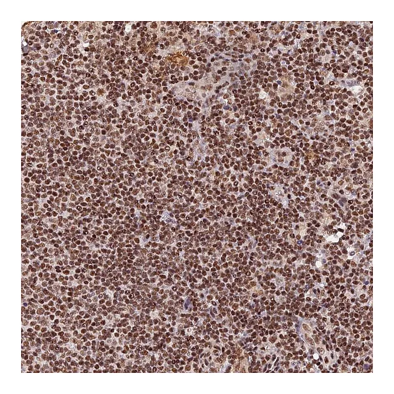 Atlas Antibodies Anti-THAP11 Antibody