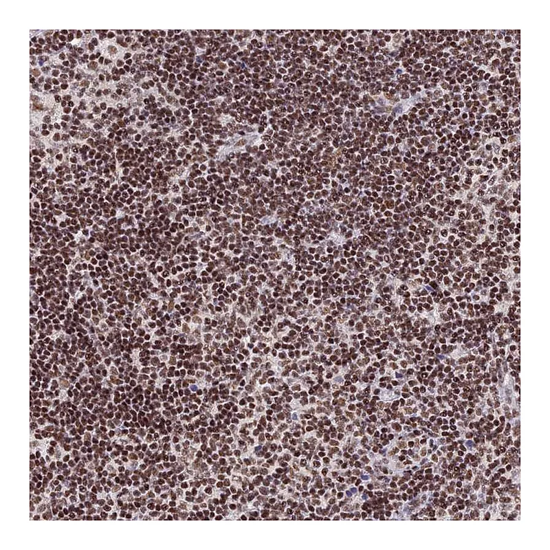 Atlas Antibodies Anti-THAP11 Antibody
