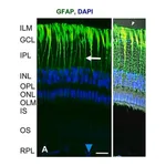Merck Anti-Glial Fibrillary Acidic Protein antibody, Mouse monoclonal