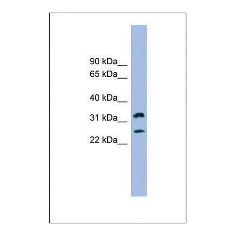 Merck Anti-FCER1A, (N-terminal) antibody produced in rabbit