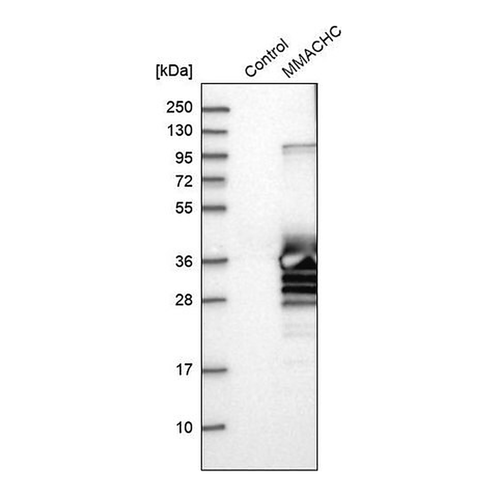 Merck Anti-MMACHC antibody produced in rabbit