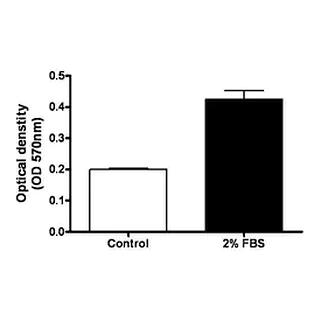 Merck QCM Endothelial Cell Invasion Assay (24 well, colorimetric)