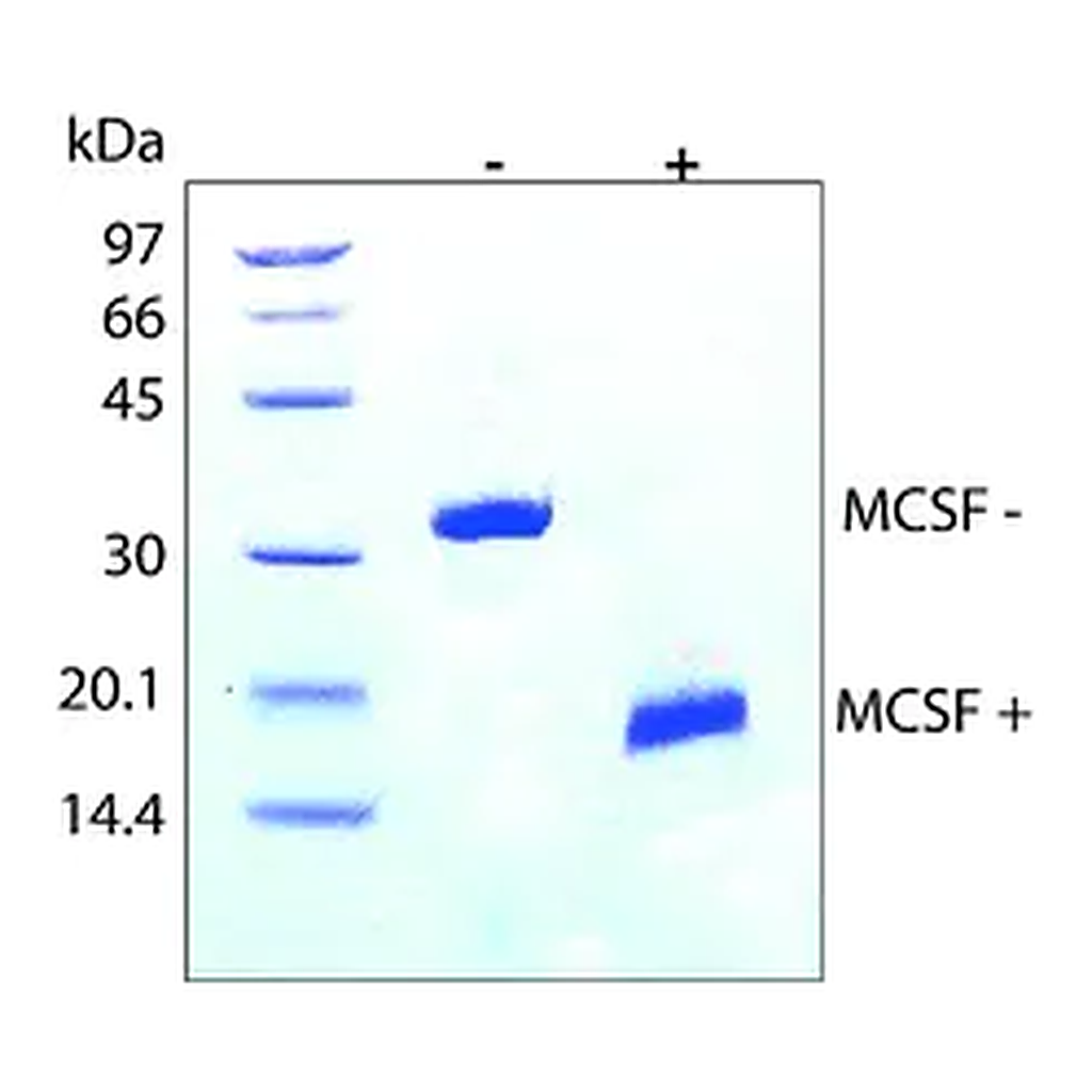 Merck Macrophage Colony-Stimulating Factor human