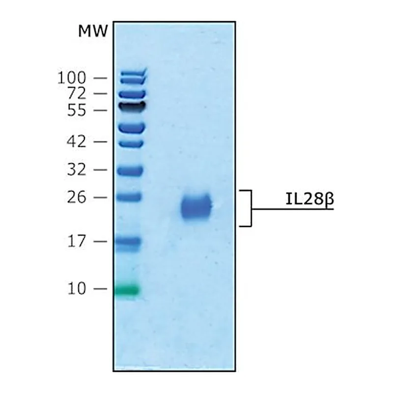 Merck IL28β human