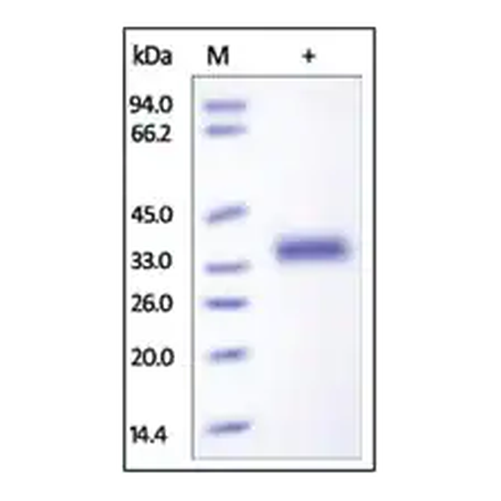 Merck IL-2 R beta/CD122 human