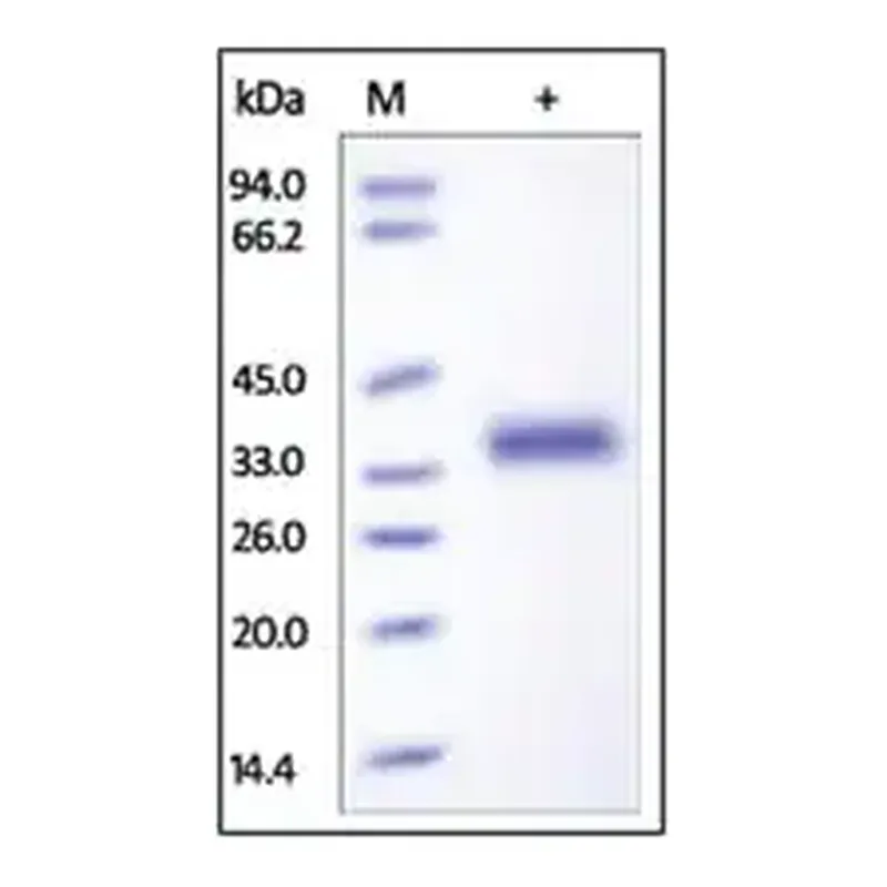Merck IL-2 R beta/CD122 human