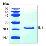 Merck Interleukin-6 human