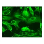Merck Human Renal Proximal Tubular Epithelial Cells: HRPTEpC, adult