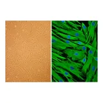 Merck Hair Follicle Dermal Papilla Cells: HFDPC, adult