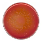 Merck MacConkey Agar