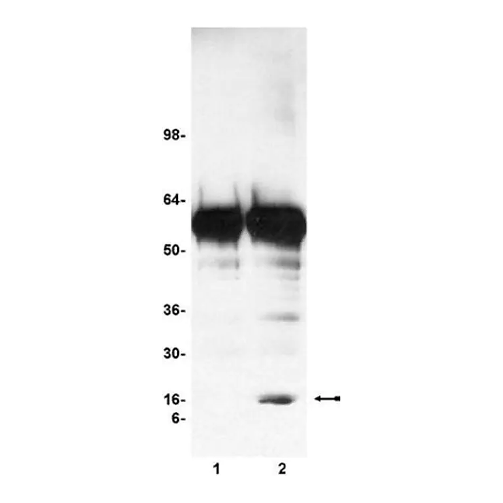 Merck Chromatin Immunoprecipitation (ChIP) Assay Kit