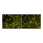 Merck Lipopolysaccharides from Escherichia coli O111:B4