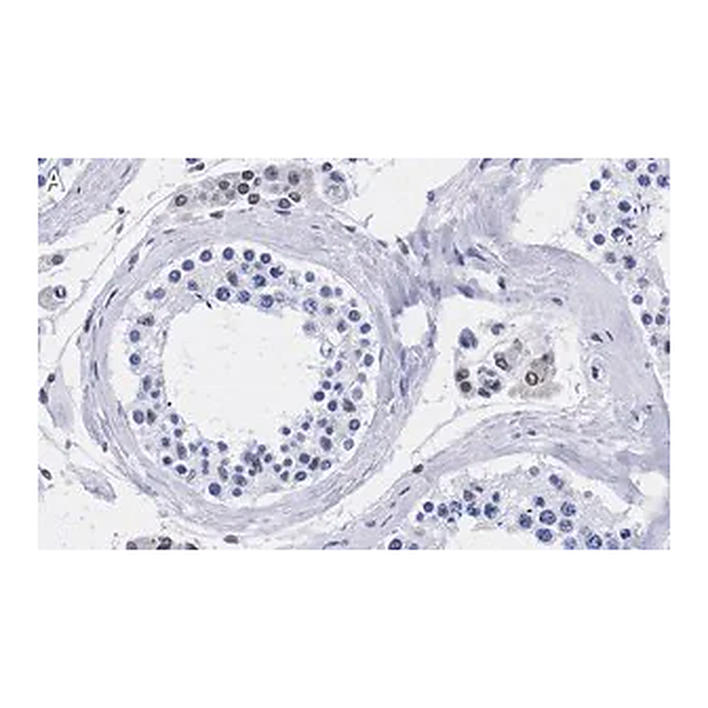 Merck Anti-TFE3 Antibody, clone 1G5 ZooMAb Rabbit Monoclonal