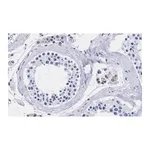 Merck Anti-TFE3 Antibody, clone 1G5 ZooMAb Rabbit Monoclonal