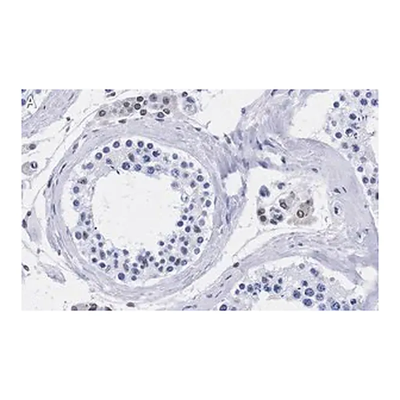 Merck Anti-TFE3 Antibody, clone 1G5 ZooMAb Rabbit Monoclonal