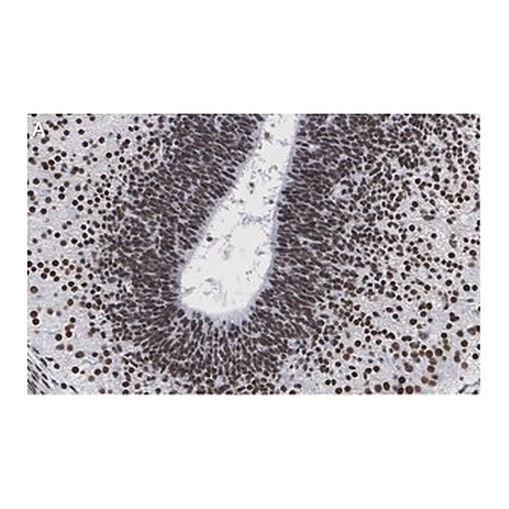 Merck Anti-LMX-1 Antibody, clone 4L12, ZooMAb Rabbit Monoclonal