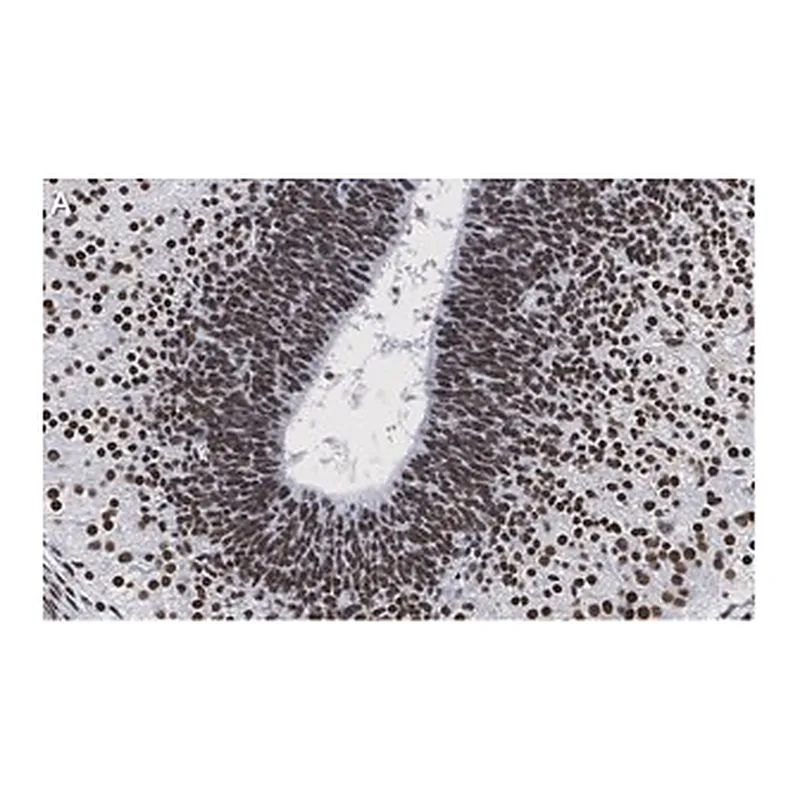 Merck Anti-LMX-1 Antibody, clone 4L12, ZooMAb Rabbit Monoclonal