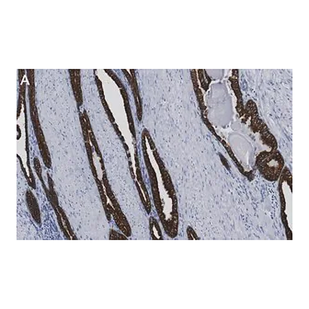 Merck Anti-Cytokeratin-8 Antibody, clone 2D17 ZooMAb Rabbit Monoclonal