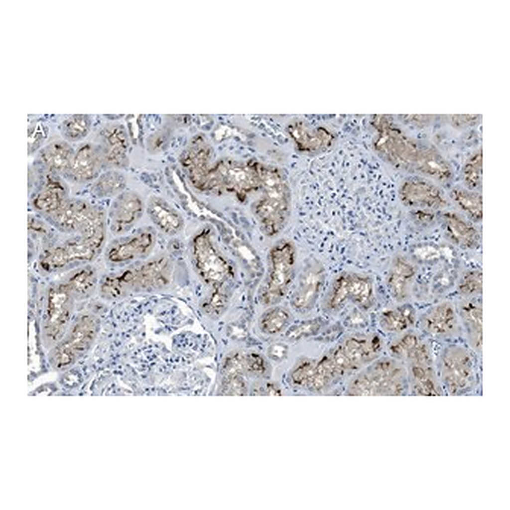 Merck Anti-Rab7A Antibody, clone 4E15 ZooMAb Rabbit Monoclonal