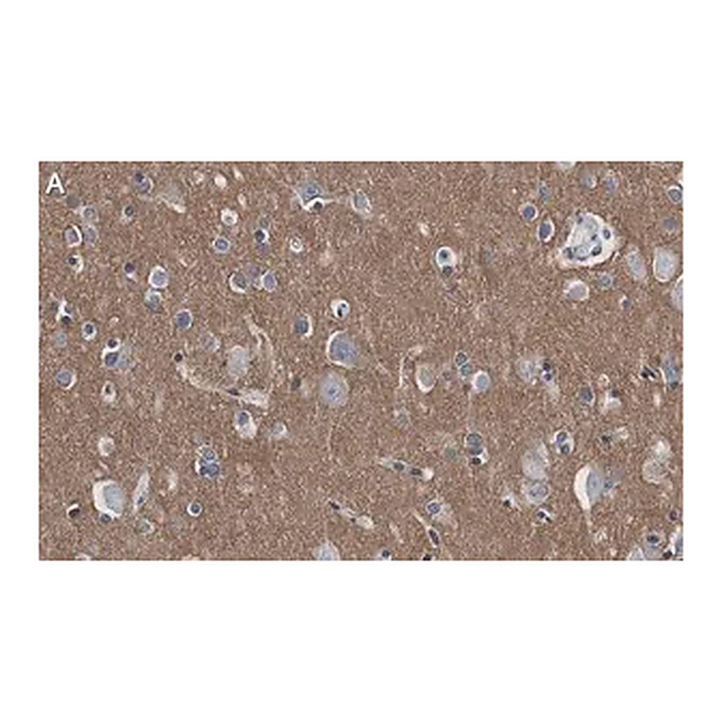 Merck Anti-CD56 Antibody, clone 3F5 ZooMAb Rabbit Monoclonal