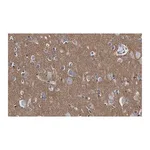 Merck Anti-CD56 Antibody, clone 3F5 ZooMAb Rabbit Monoclonal