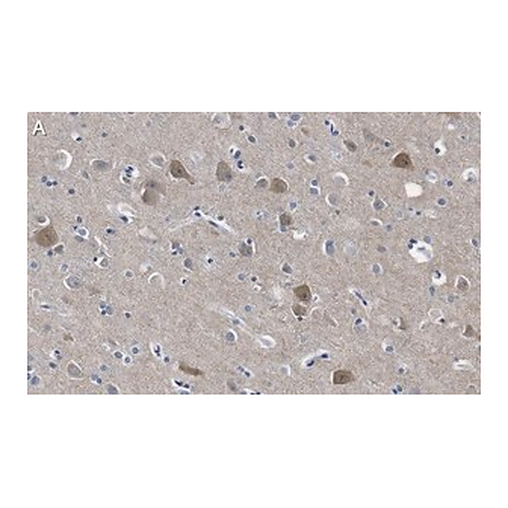 Merck Anti-PSD-95 Antibody, clone 2B20 ZooMAb Rabbit Monoclonal