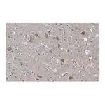 Merck Anti-PSD-95 Antibody, clone 2B20 ZooMAb Rabbit Monoclonal