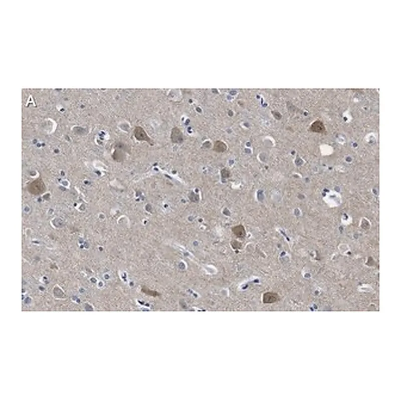 Merck Anti-PSD-95 Antibody, clone 2B20 ZooMAb Rabbit Monoclonal
