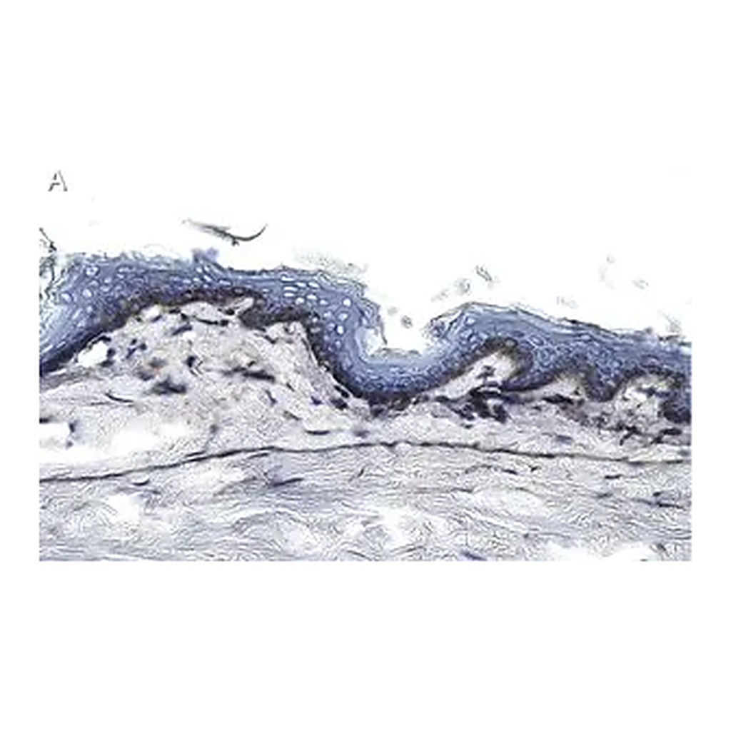 Merck Anti-Collagen Type VII Antibody, clone 1E5 ZooMAb Rabbit Monoclonal