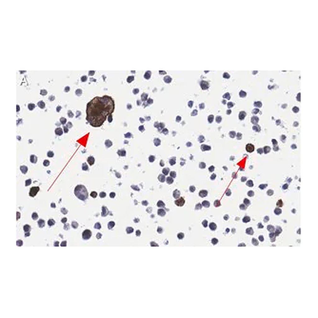 Merck Anti-RSV Fusion Protein Antibody, clone 131-2A ZooMAb Mouse Monoclonal