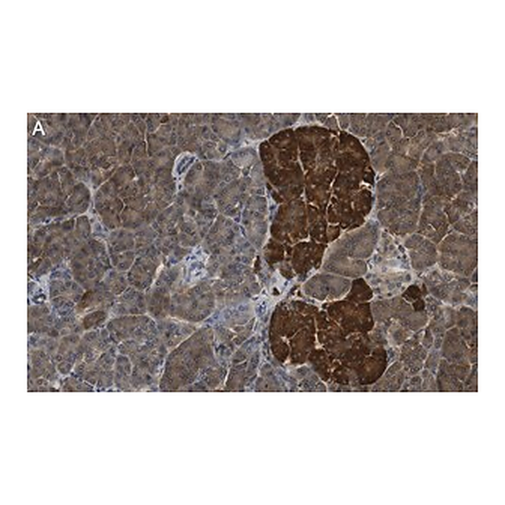 Merck Anti-CNKSR1 Antibody, clone 4B7 ZooMAb Rabbit Monoclonal