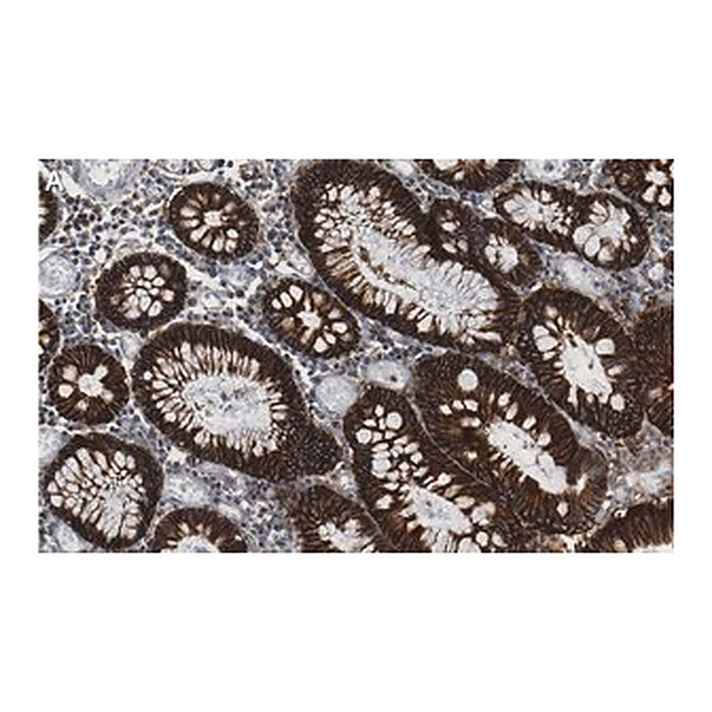 Merck Anti-Na+/K+ ATPase α1 Antibody, clone 2M18 ZooMAb Rabbit Monoclonal