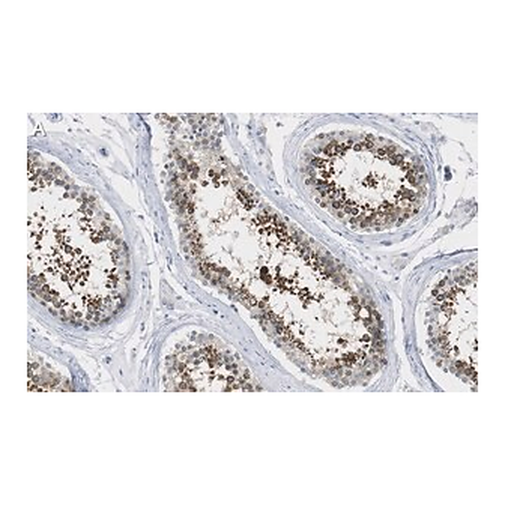 Merck Anti-ANKRD11 Antibody, clone 1H14 ZooMAb Rabbit Monoclonal
