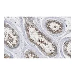 Merck Anti-ANKRD11 Antibody, clone 1H14 ZooMAb Rabbit Monoclonal