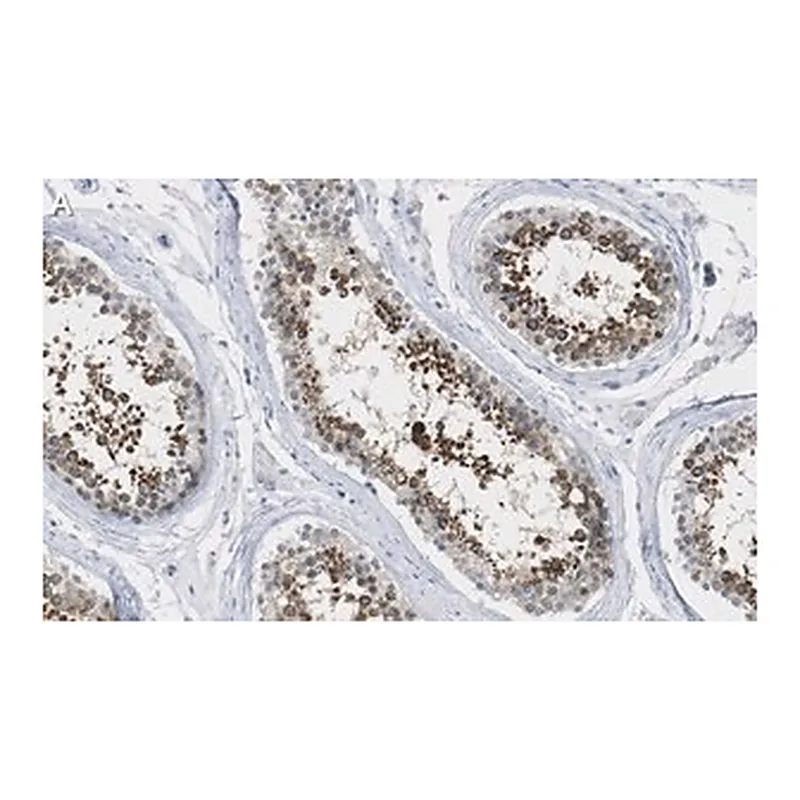 Merck Anti-ANKRD11 Antibody, clone 1H14 ZooMAb Rabbit Monoclonal