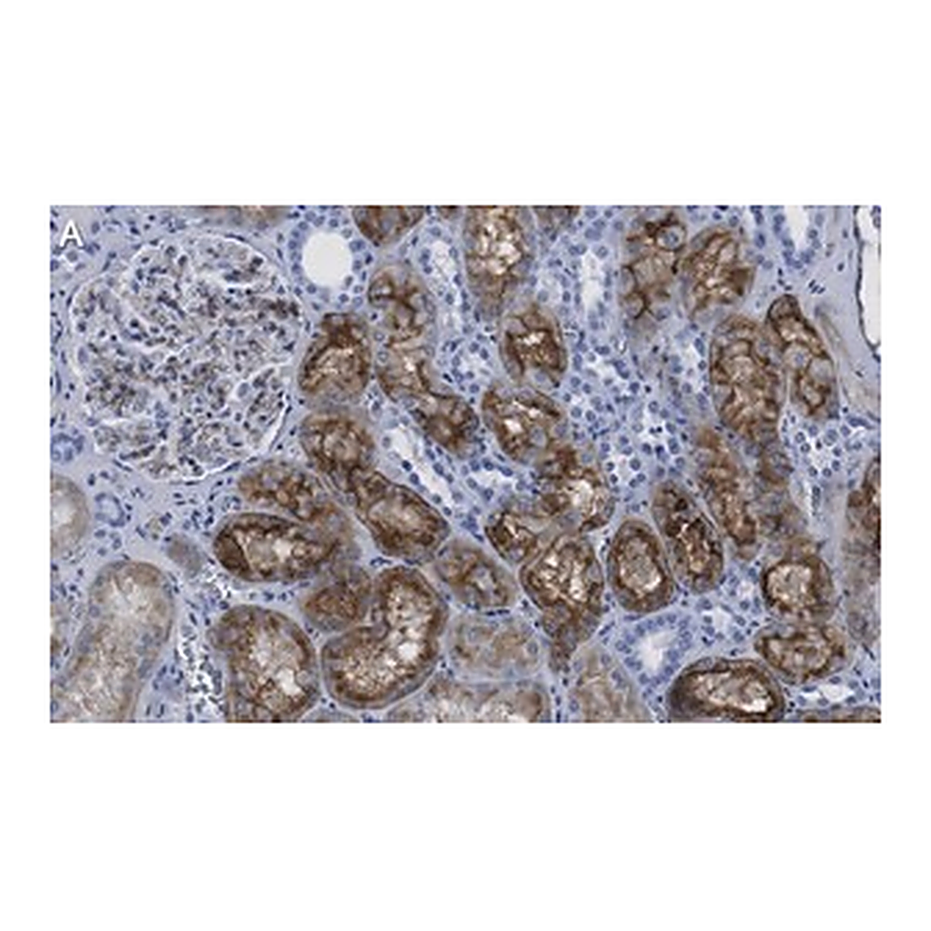 Merck Anti-Aquaporin-1 Antibody, clone 2I7 ZooMAb Rabbit Monoclonal