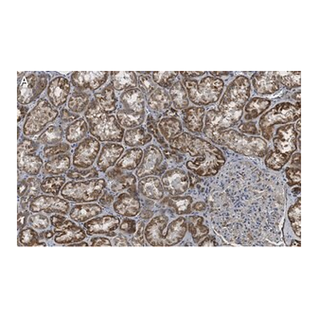 Merck Anti-ULK2 Antibody, clone 3E19 ZooMAb Rabbit Monoclonal