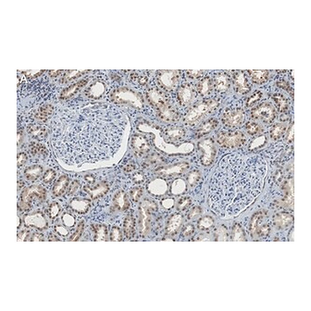 Merck Anti-CARM1 Antibody, clone 2H11 ZooMAb Rabbit Monoclonal