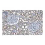 Merck Anti-CARM1 Antibody, clone 2H11 ZooMAb Rabbit Monoclonal