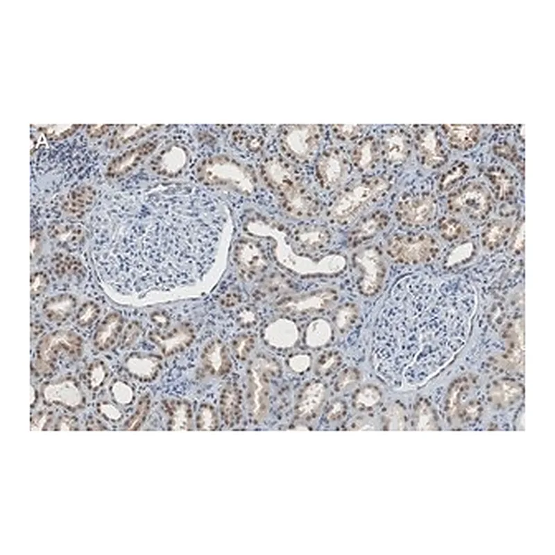 Merck Anti-CARM1 Antibody, clone 2H11 ZooMAb Rabbit Monoclonal