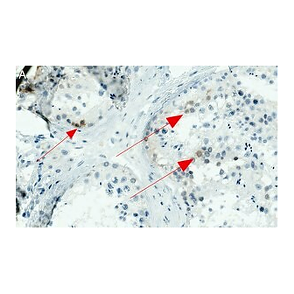 Merck Anti-NY-ESO-1 Antibody, clone 1J11 ZooMAb Rabbit Monoclonal